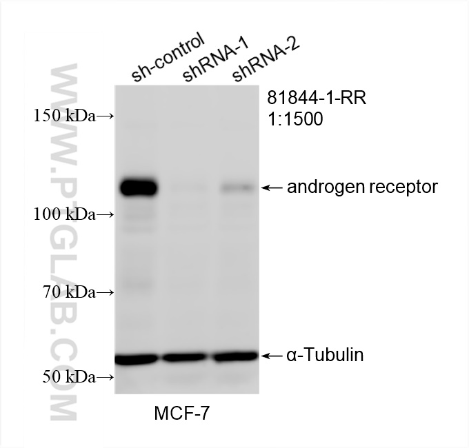 WB analysis of MCF-7 using 81844-1-RR (same clone as 81844-1-PBS)