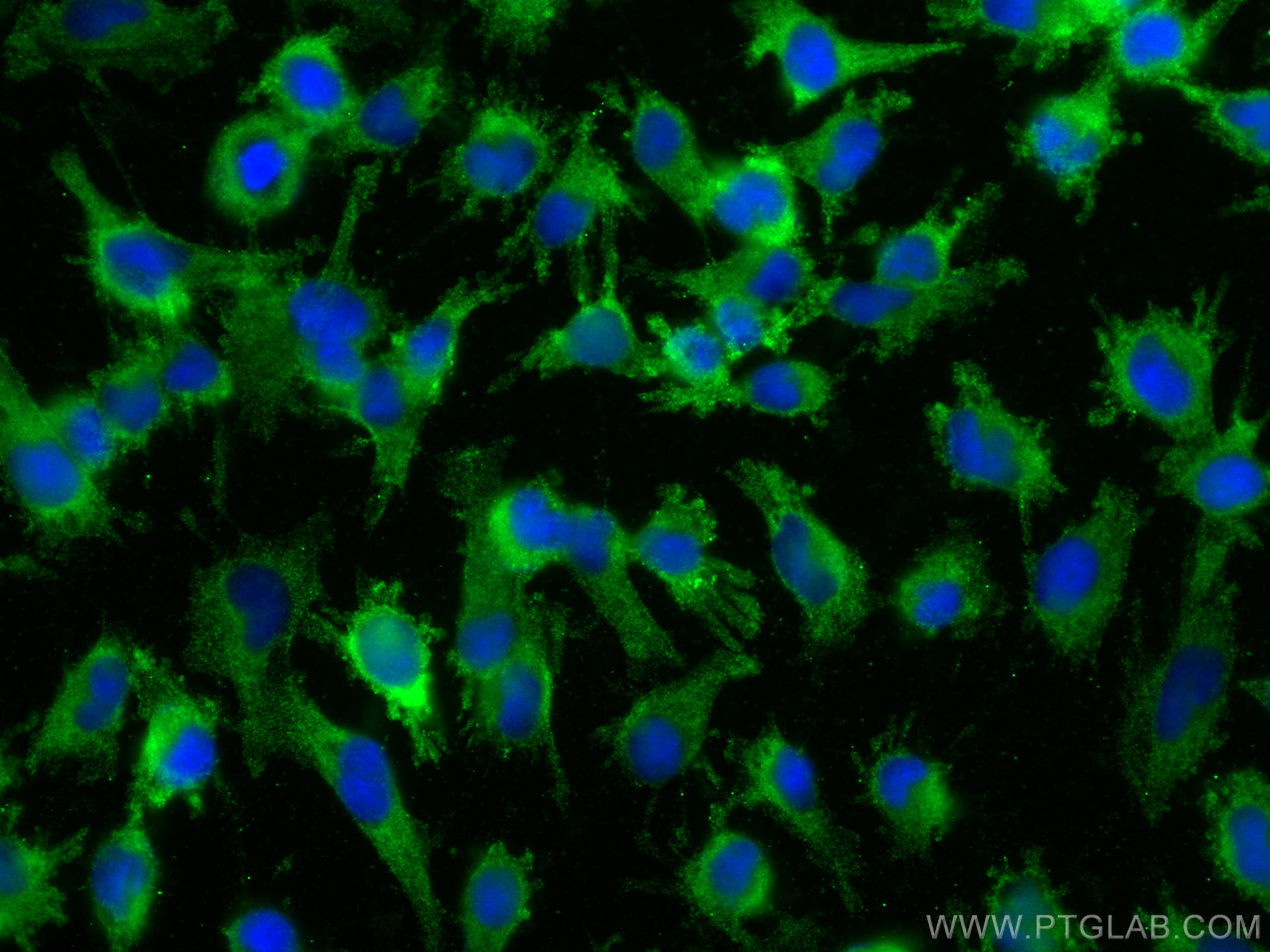 IF Staining of U-251 using 68225-1-Ig (same clone as 68225-1-PBS)