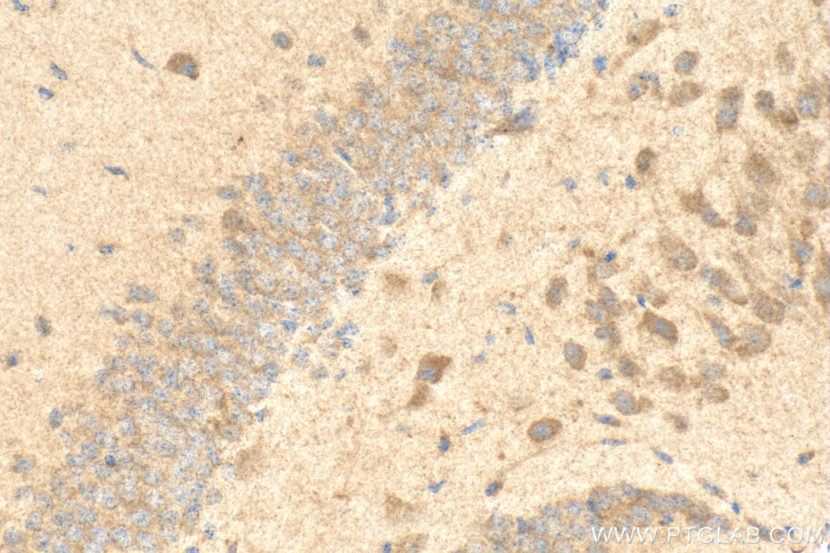 IHC staining of mouse brain using 25128-1-AP