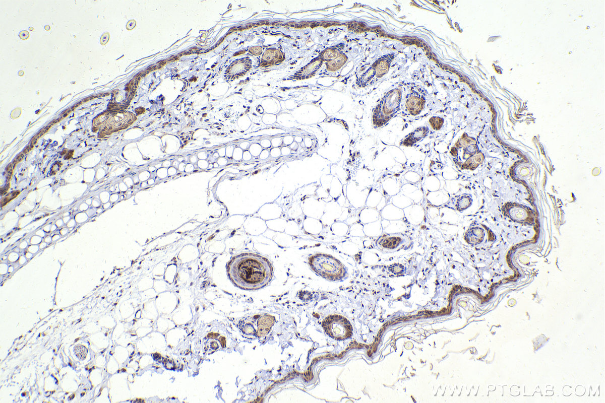 IHC staining of rat skin using 67686-1-Ig