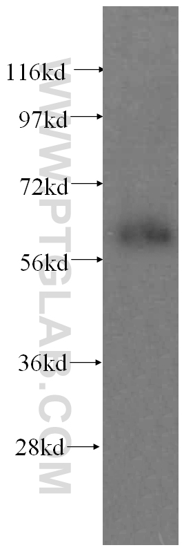 WB analysis of human kidney using 15827-1-AP