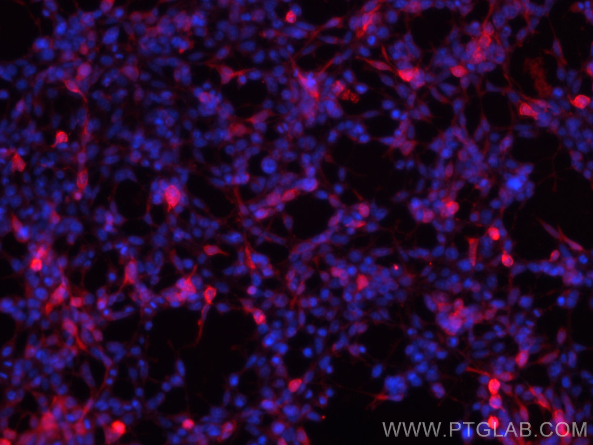 IF Staining of Transfected HEK-293 using 50430-2-AP