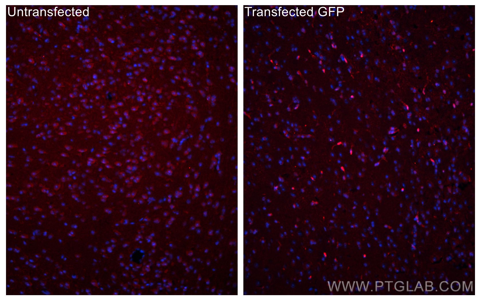 IF Staining of mouse brain using 50430-2-AP