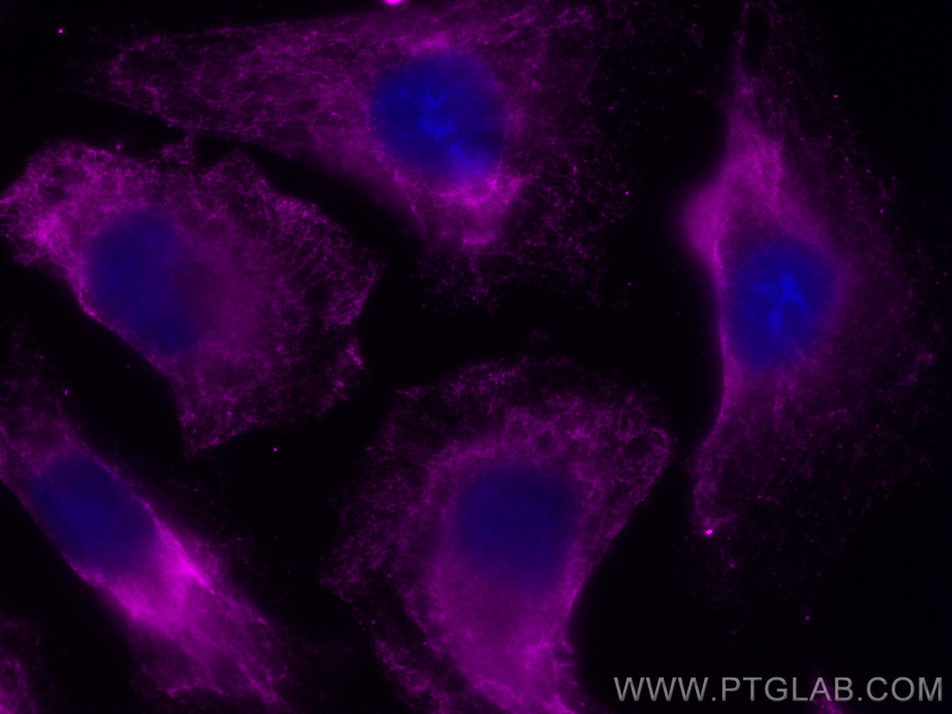 IF Staining of HeLa using CL647-67428