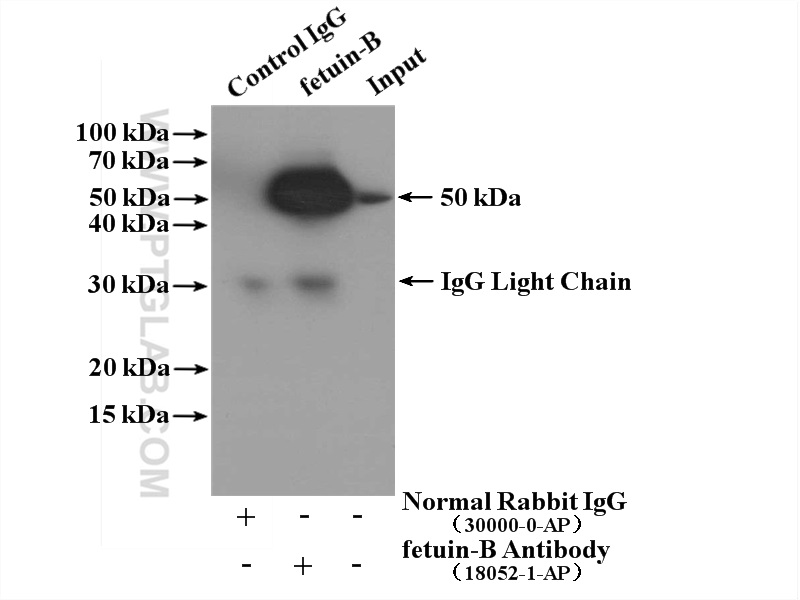 IP experiment of human plasma using 18052-1-AP