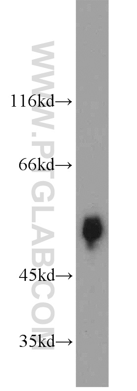 WB analysis of human plasma using 18052-1-AP