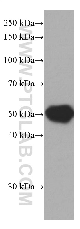 WB analysis of human blood using 67002-1-Ig