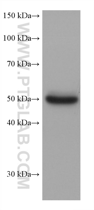 WB analysis of human plasma using 67002-1-Ig