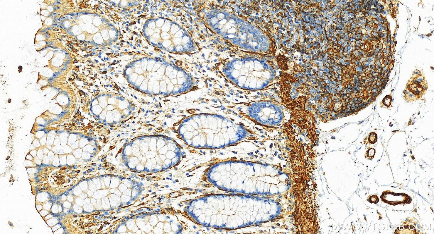 IHC staining of human  colon using 28492-1-AP