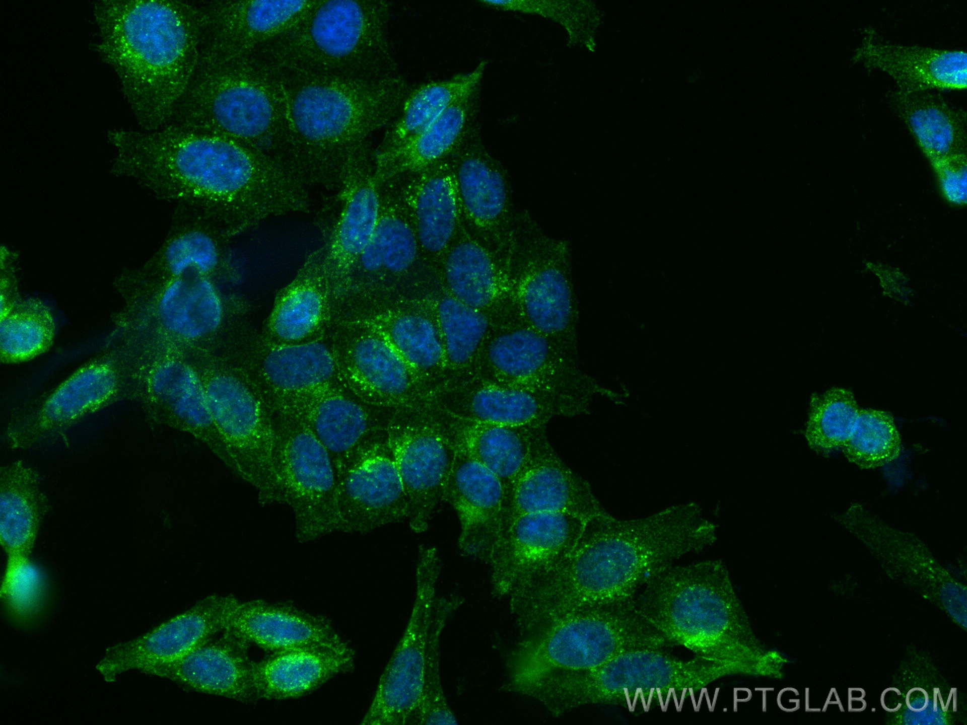 IF Staining of HepG2 using 30591-1-AP