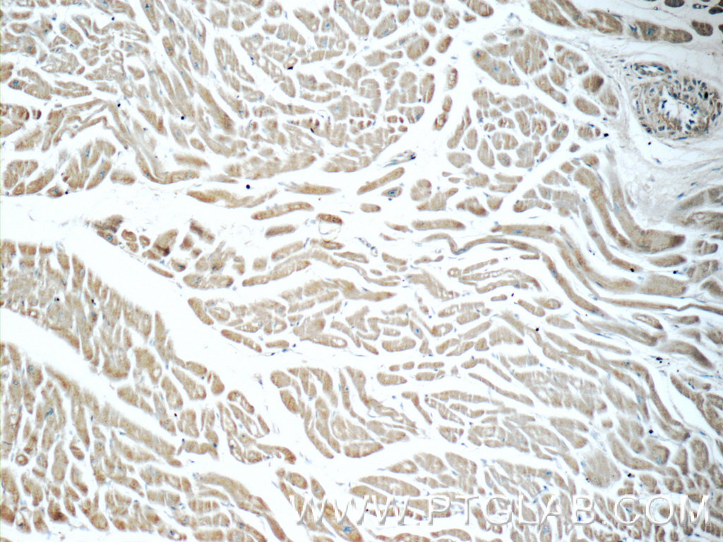 IHC staining of human heart using 25885-1-AP