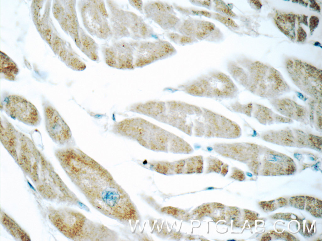 IHC staining of human heart using 25885-1-AP