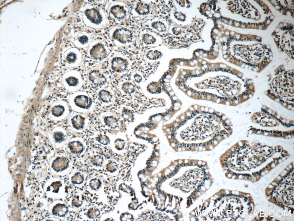 IHC staining of human small intestine using 25885-1-AP