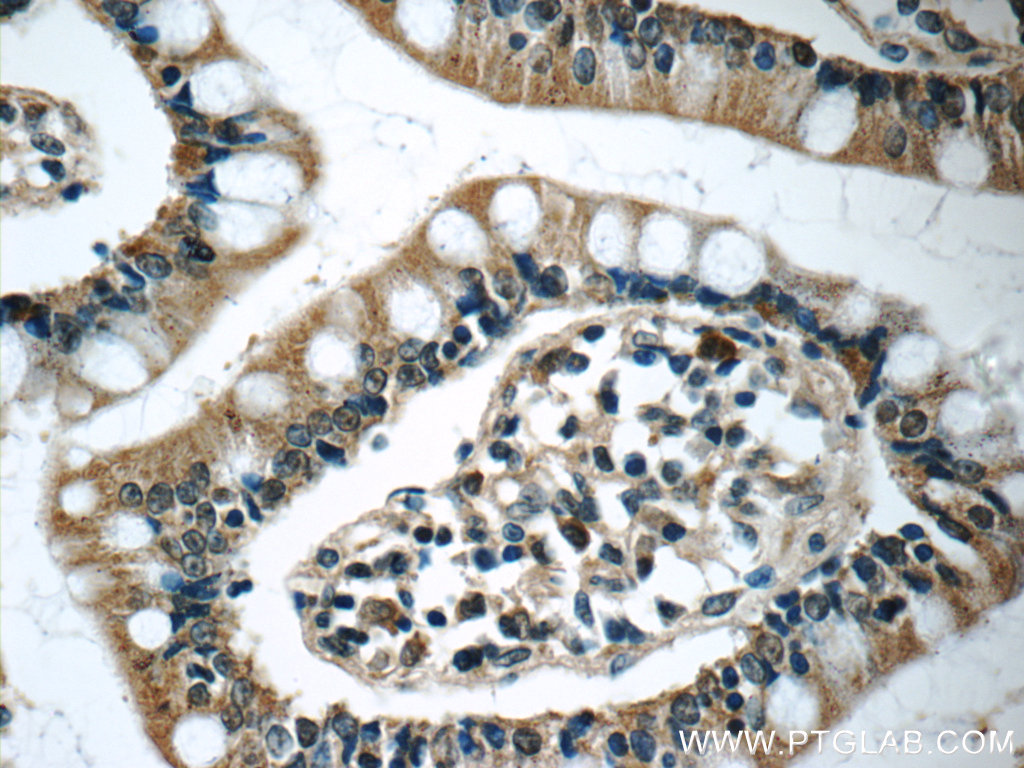 IHC staining of human small intestine using 25885-1-AP