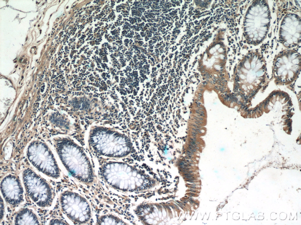 IHC staining of human colon using 25886-1-AP