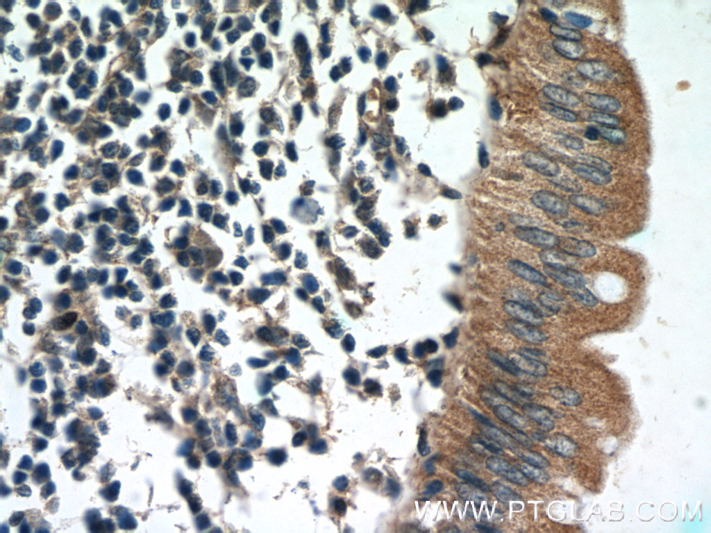 IHC staining of human colon using 25886-1-AP