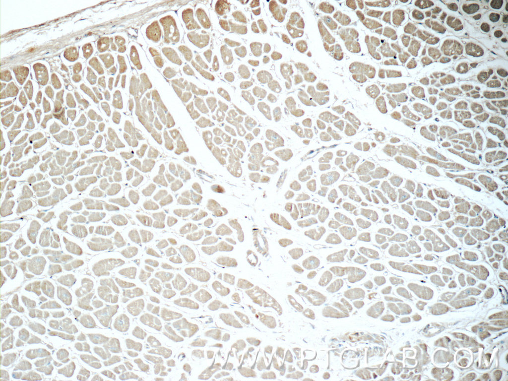 IHC staining of human heart using 25886-1-AP