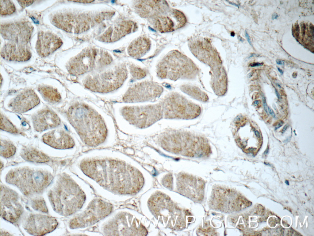 IHC staining of human heart using 25886-1-AP