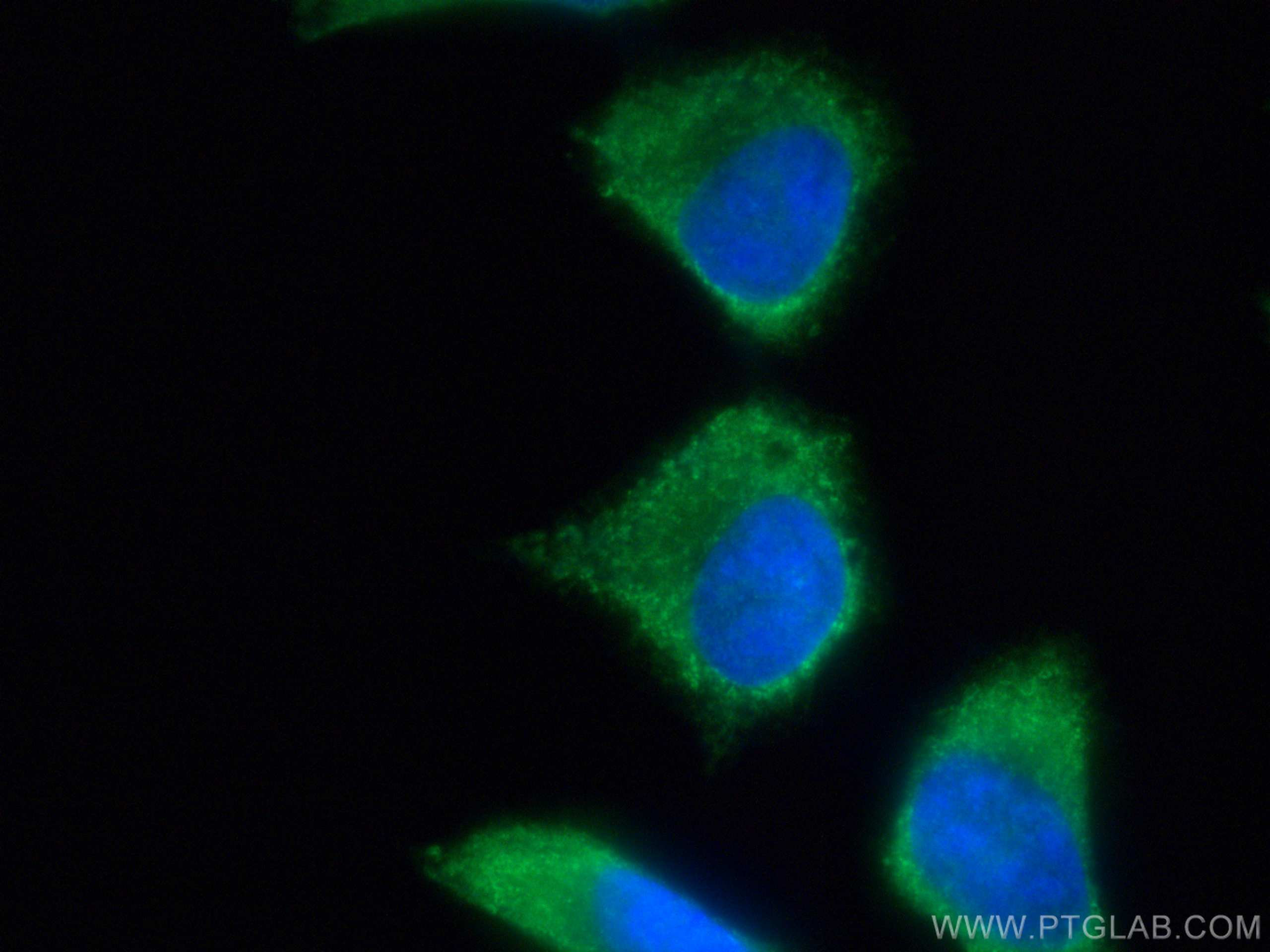 IF Staining of HepG2 using CL488-18985