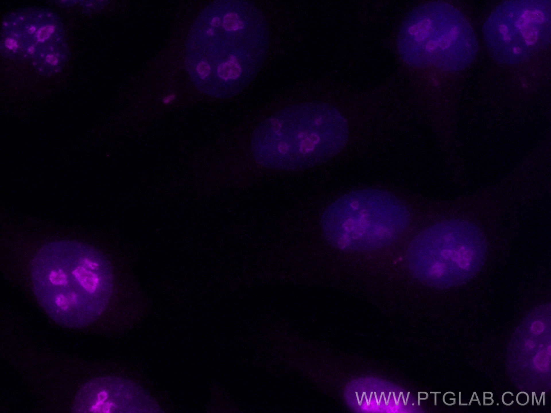 IF Staining of HeLa using CL647-28074