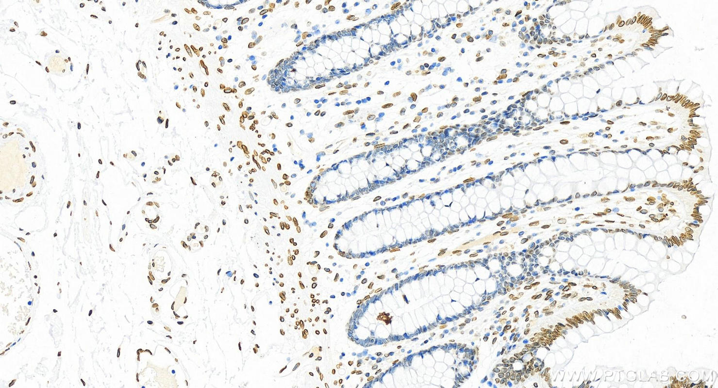 IHC staining of human normal colon using 10298-1-AP