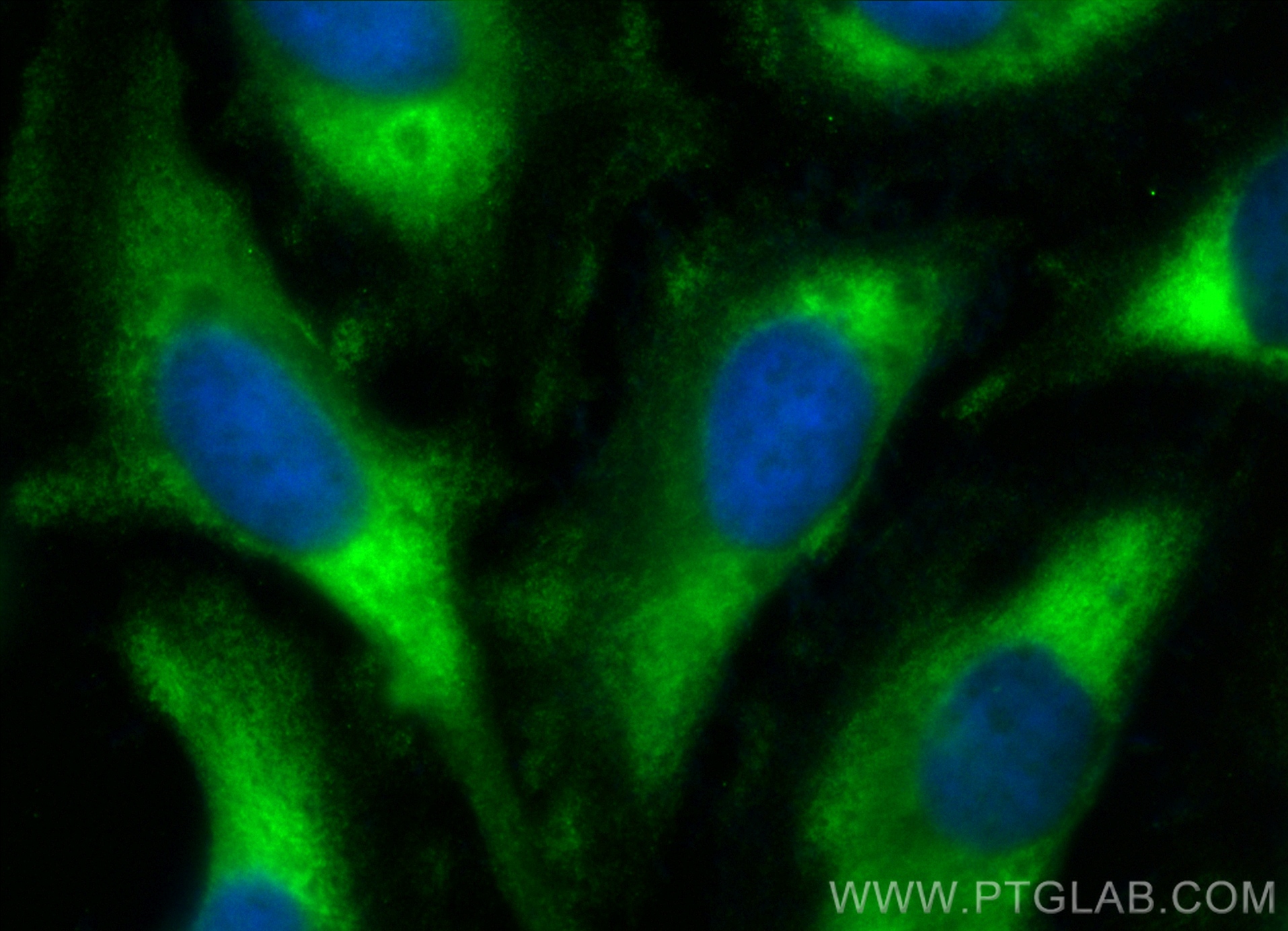 IF Staining of HeLa using CL488-28273