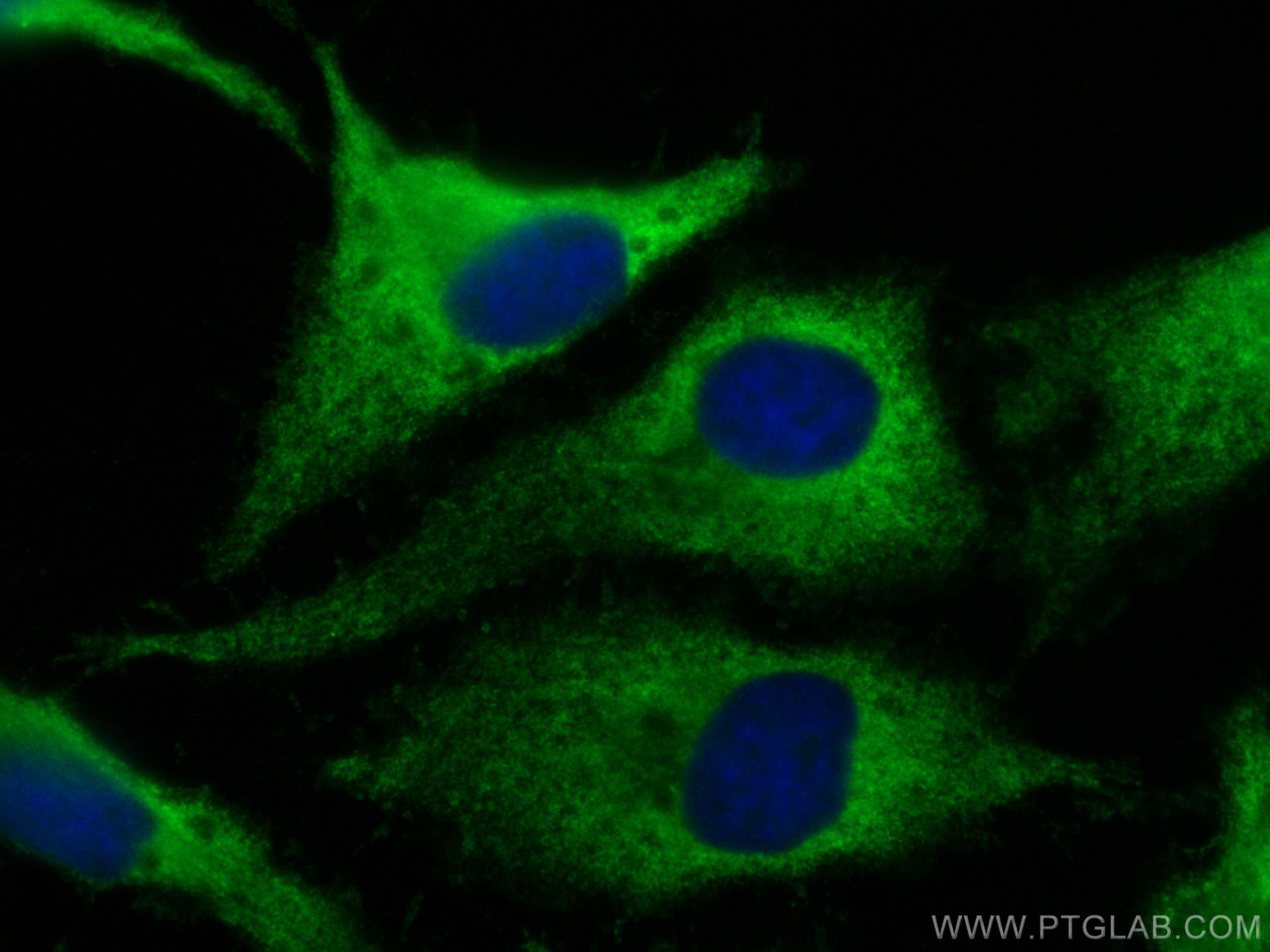 IF Staining of HeLa using CL488-16815