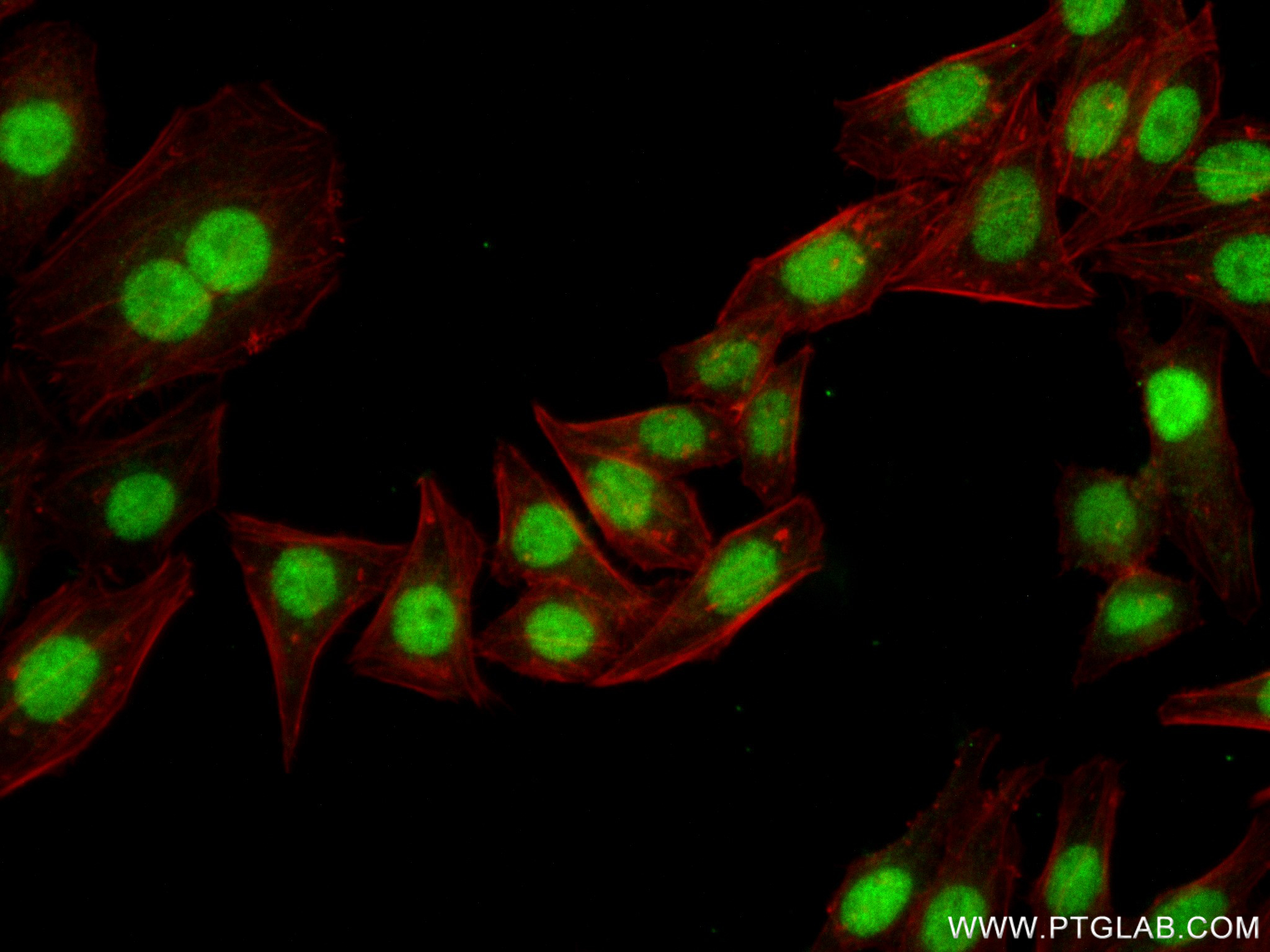 IF Staining of HepG2 using 83078-4-RR