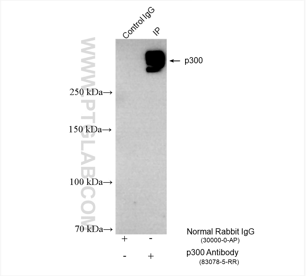 IP experiment of HeLa using 83078-5-RR