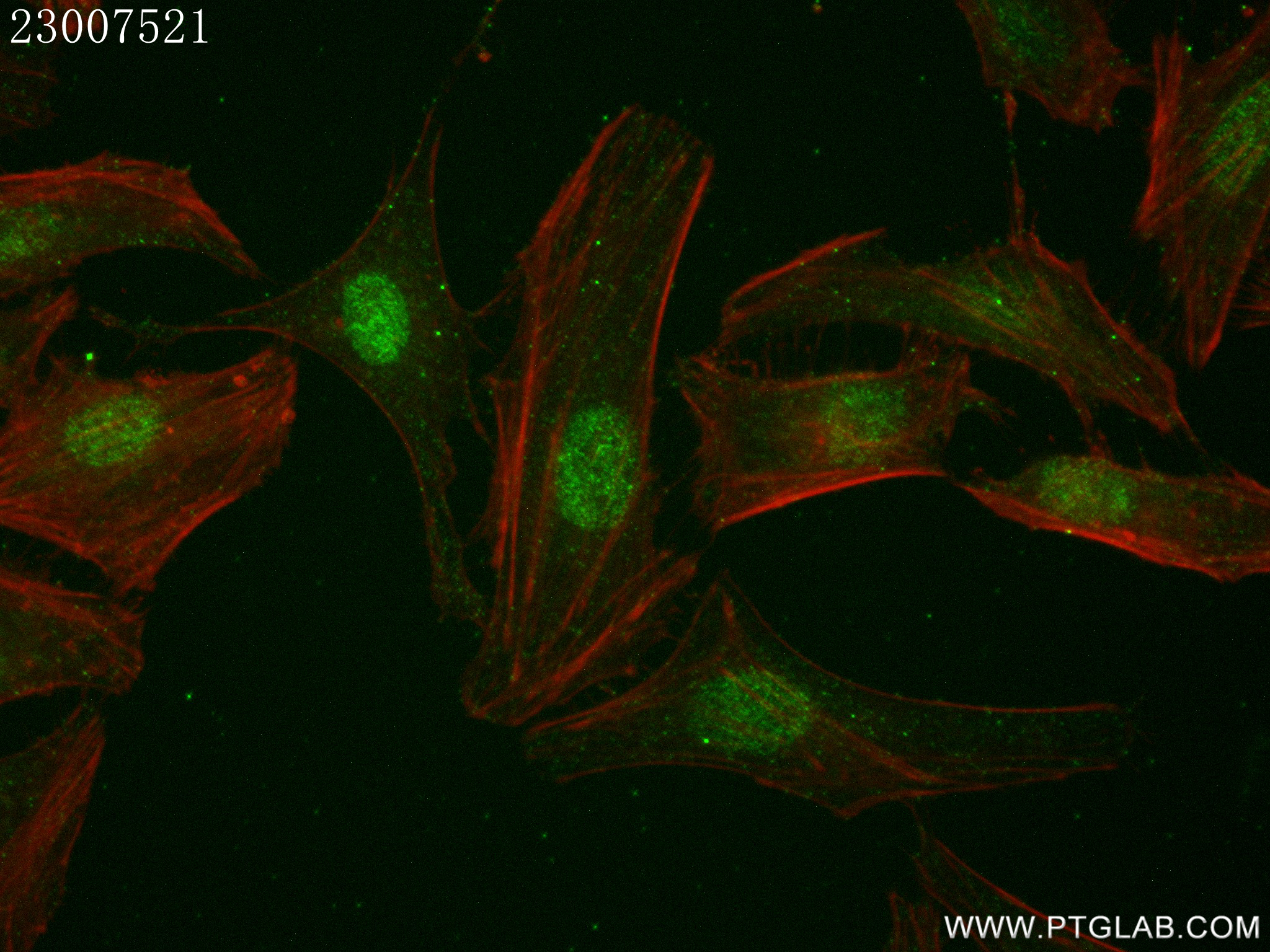 IF Staining of HeLa using 80821-2-RR