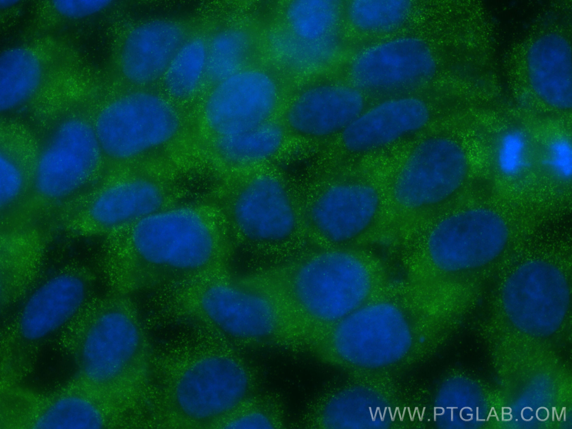 IF Staining of A431 using 60240-1-Ig (same clone as 60240-1-PBS)