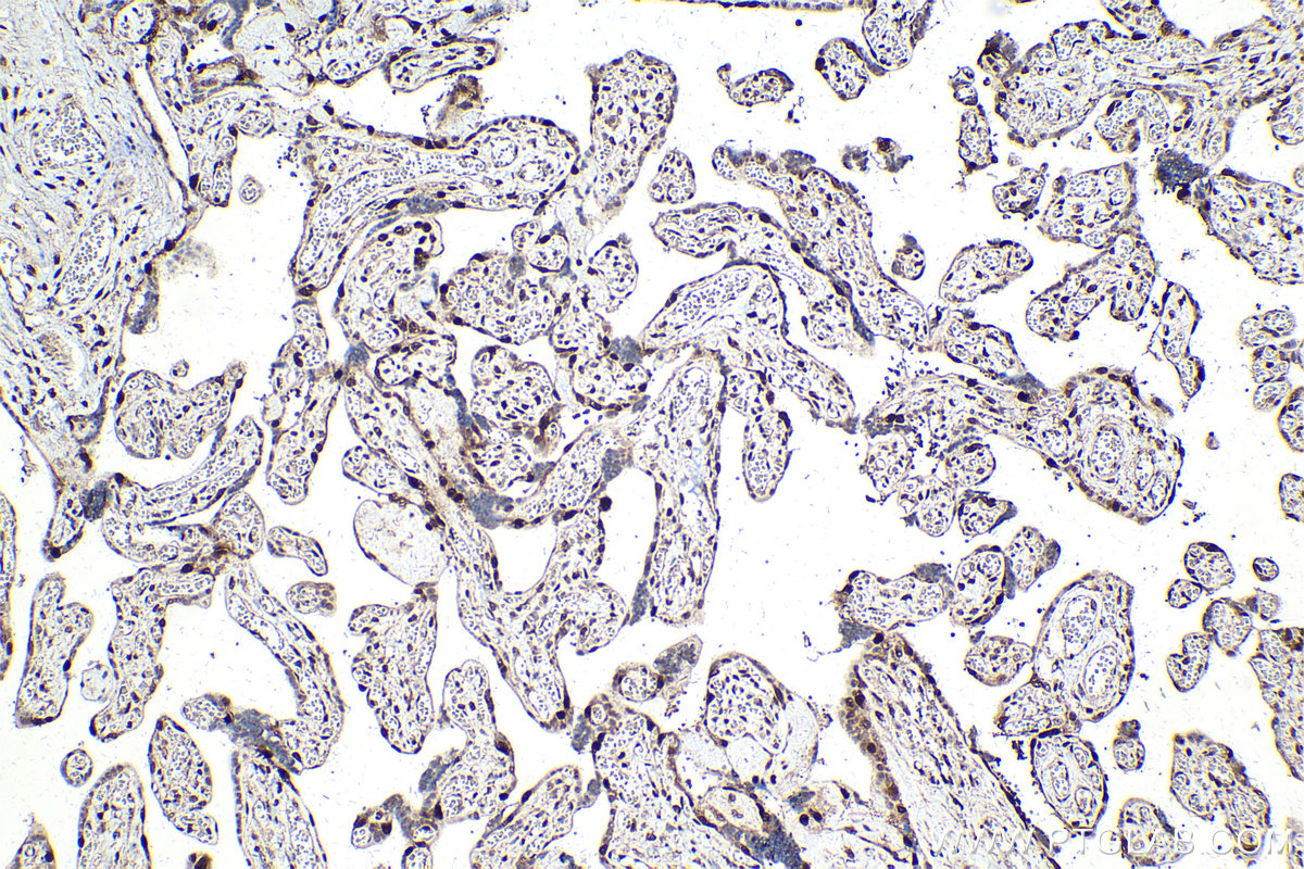 IHC staining of human placenta using 66794-1-Ig (same clone as 66794-1-PBS)