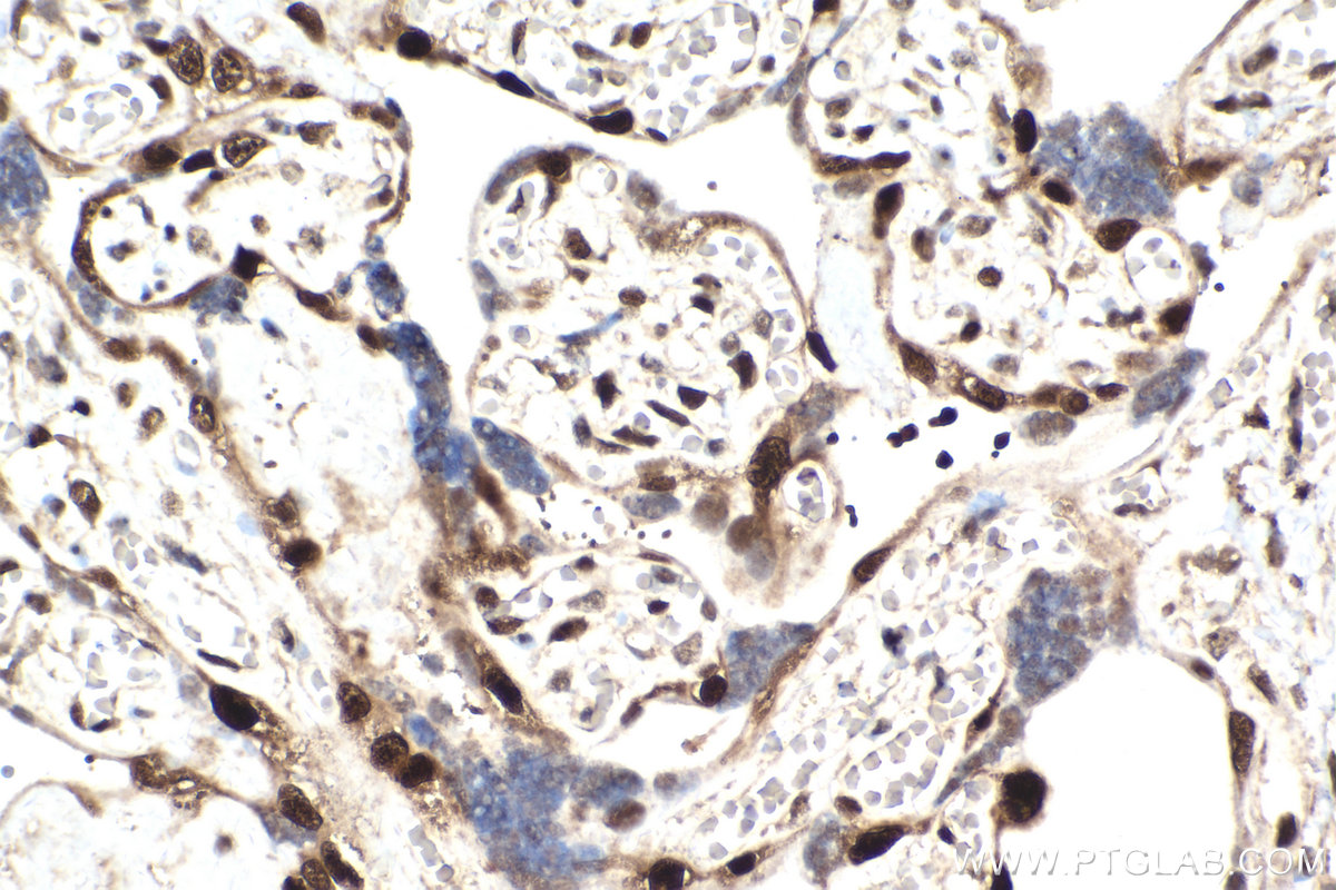 IHC staining of human placenta using 66794-1-Ig (same clone as 66794-1-PBS)