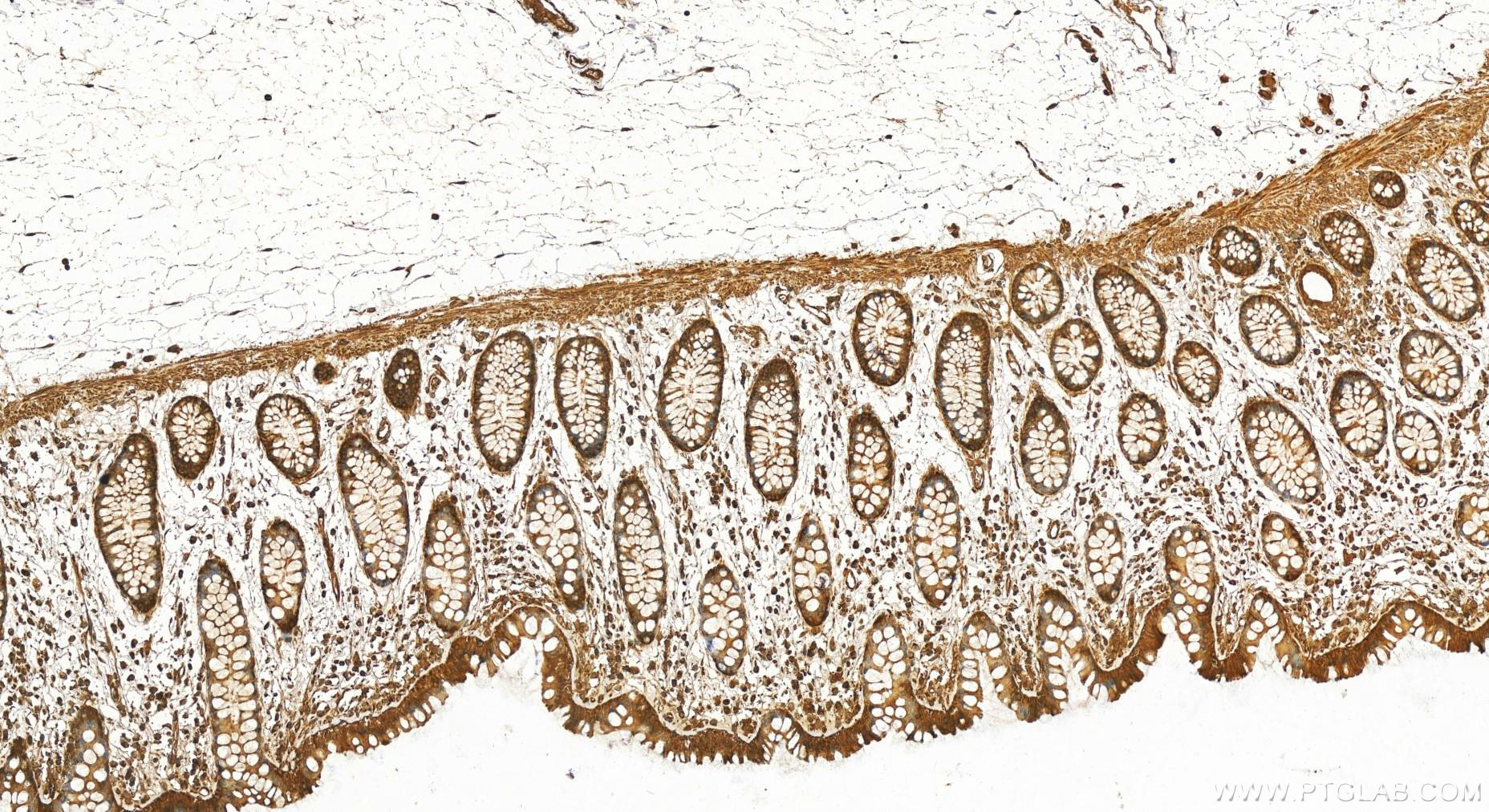 IHC staining of human colon using 10745-1-AP