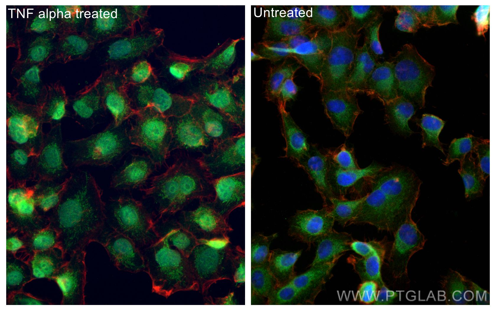 IF Staining of HT-1080 using 10745-1-AP