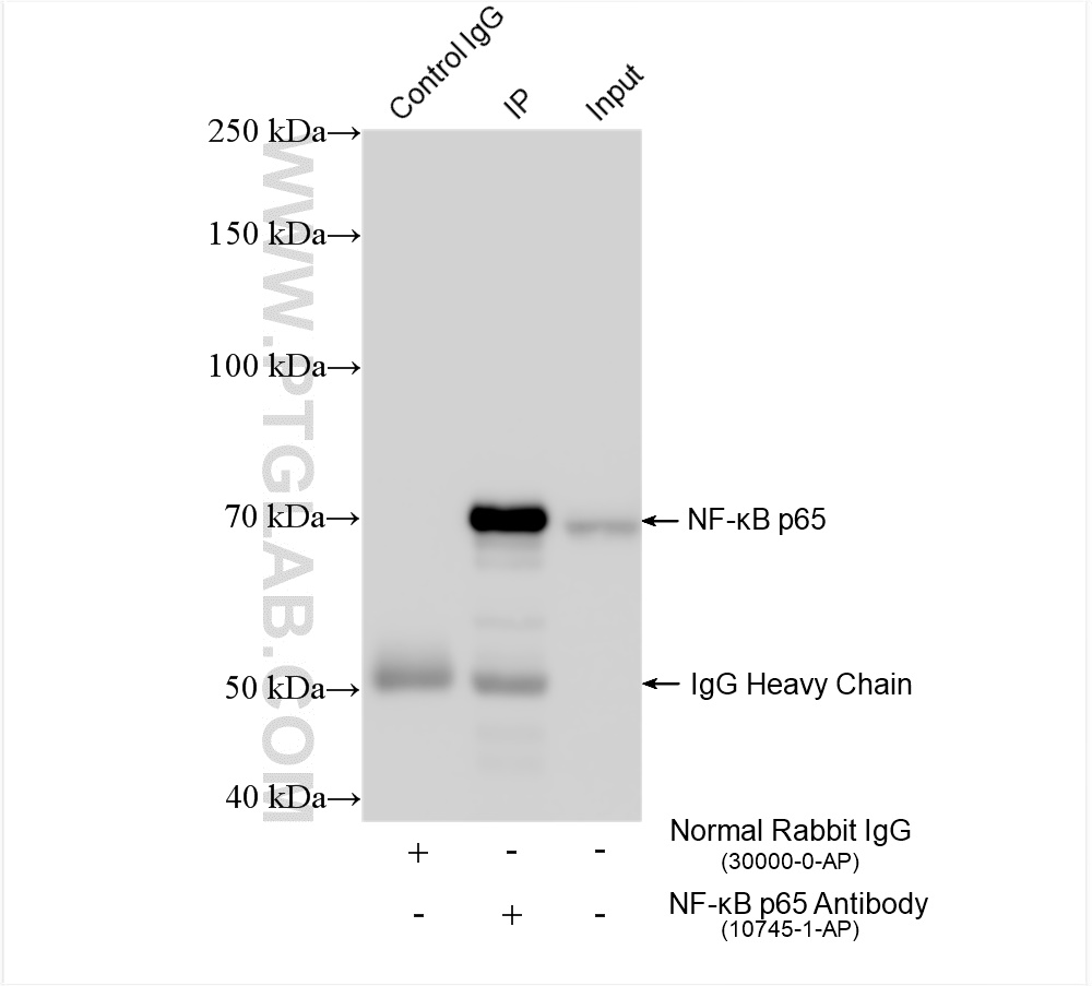 IP experiment of HeLa using 10745-1-AP