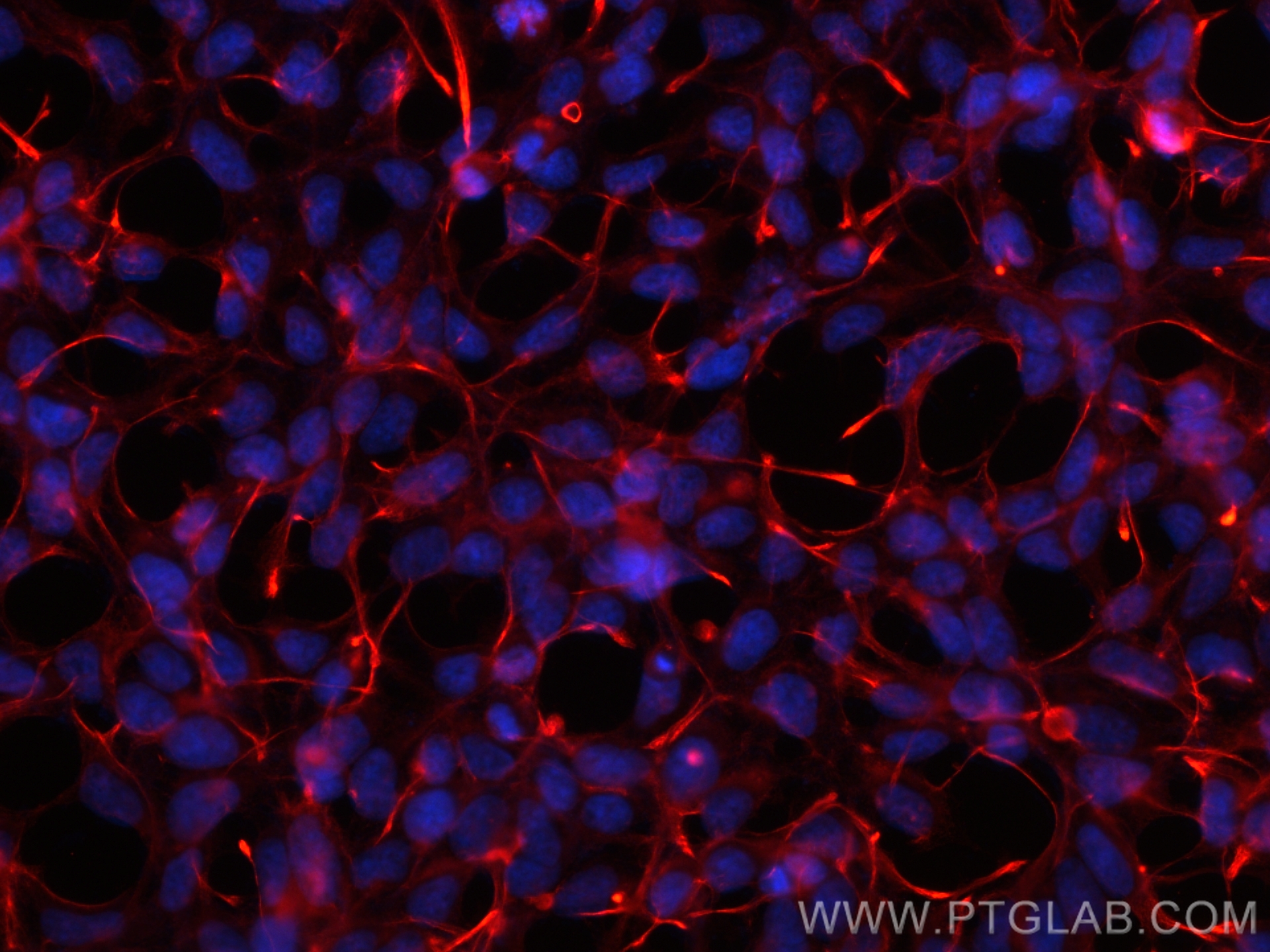 IF Staining of HEK-293 using CL594-60309