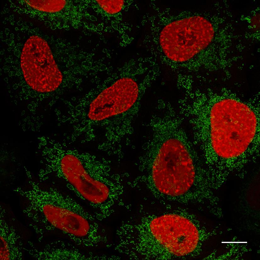 HeLa cells transiently transfected with PCNA-mRFP and Tom70-eGFP were subjected to one-step immunostaining with RFP-Booster Alexa Fluor 568 (red) and GFP-Booster Alexa Fluor 488 (green). Scale bar, 10 μm. Images were recorded at the Core Facility Bioimaging at the Biomedical Center, LMU Munich.