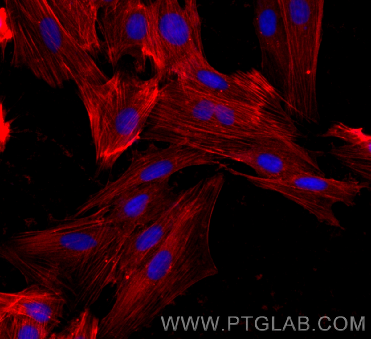 IF Staining of H9C2 using CL594-80008