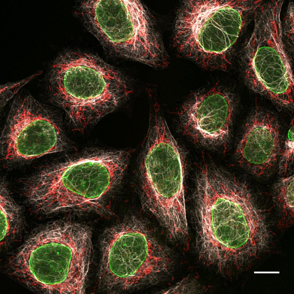 Staining image of secondary nanobody ChromoTek Nano-Secondary® alpaca anti-mouse IgG1, recombinant VHH, Alexa Fluor® 488. The anti-mouse IgG1 Nano-Secondary is subclass-specific and does not cross-react with IgGs from other commonly used species (here rabbit) and with mouse IgG2b and IgG3 subclasses.