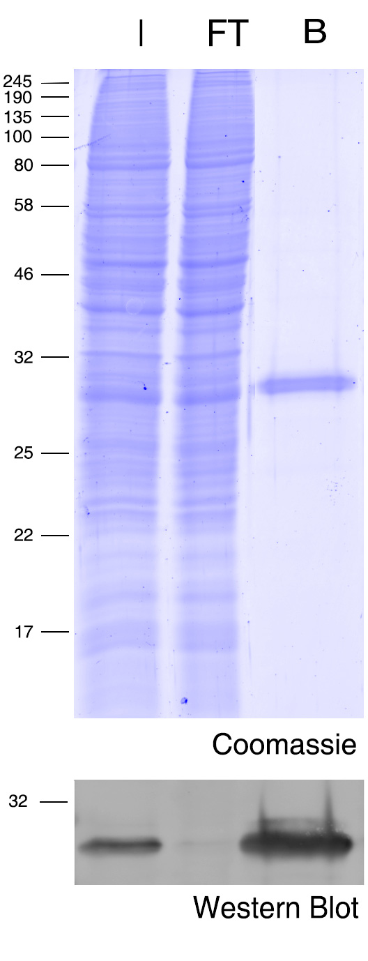 Coomassie blue stained gel and Western blot.