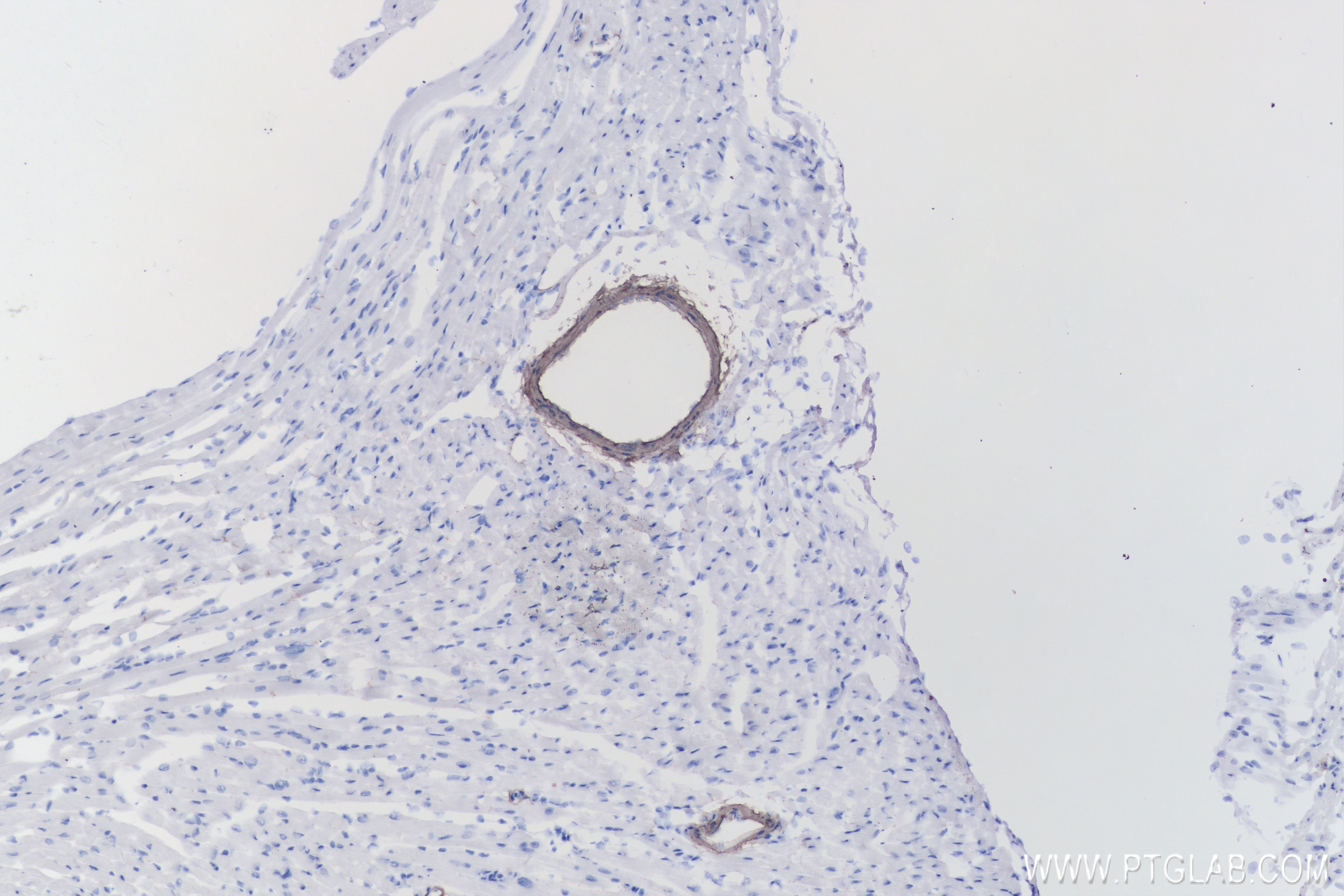 IHC staining of mouse heart using 83922-2-RR