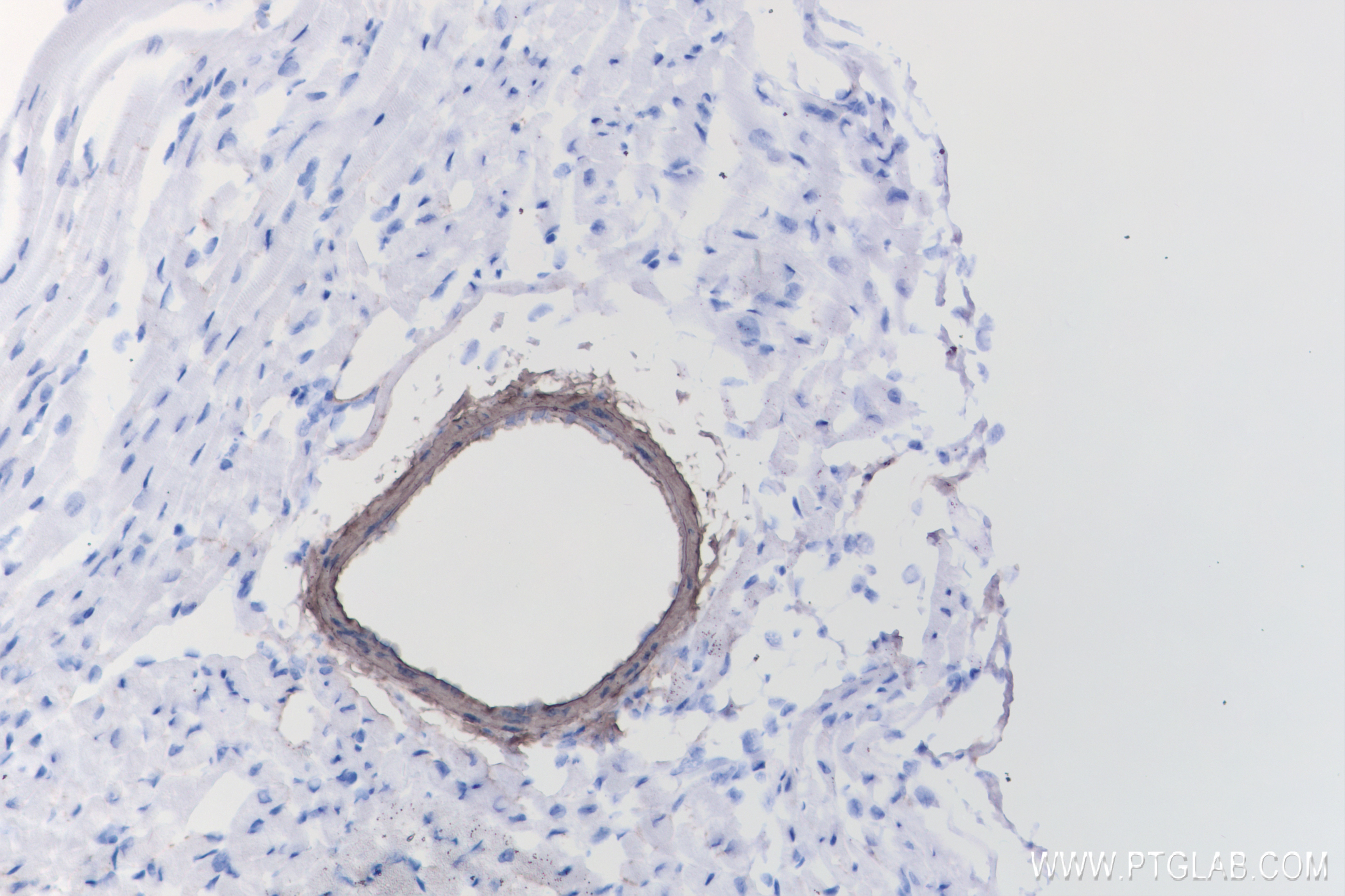 IHC staining of mouse heart using 83922-2-RR (same clone as 83922-2-PBS)