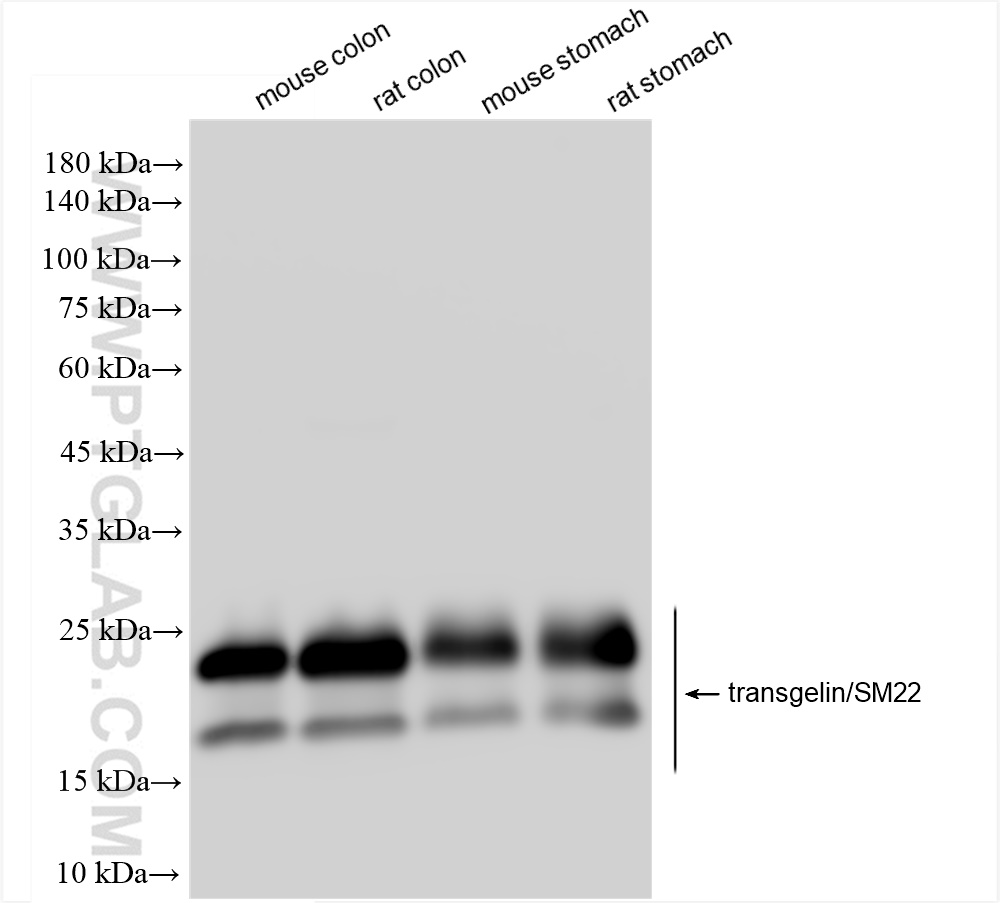 WB analysis using 83922-2-RR