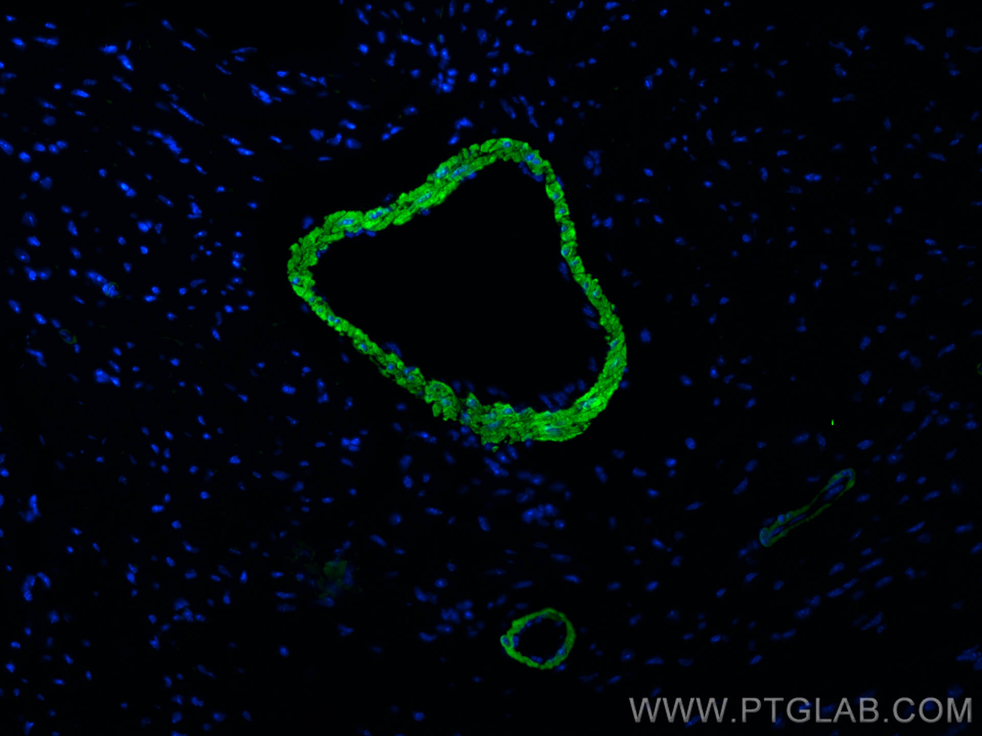 IF Staining of mouse heart using CL488-10493