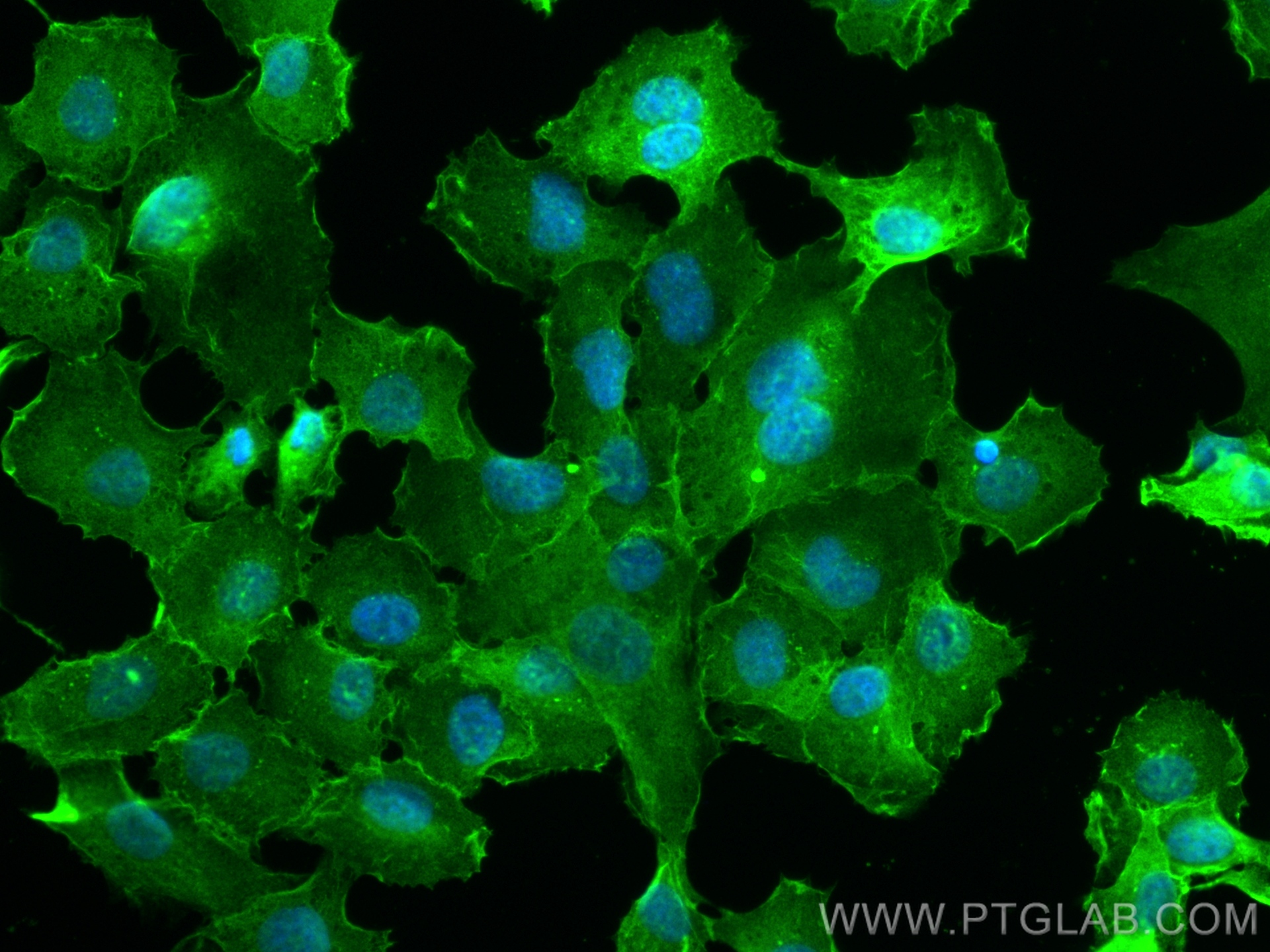 IF Staining of HT-1080 using 82953-1-RR (same clone as 82953-1-PBS)