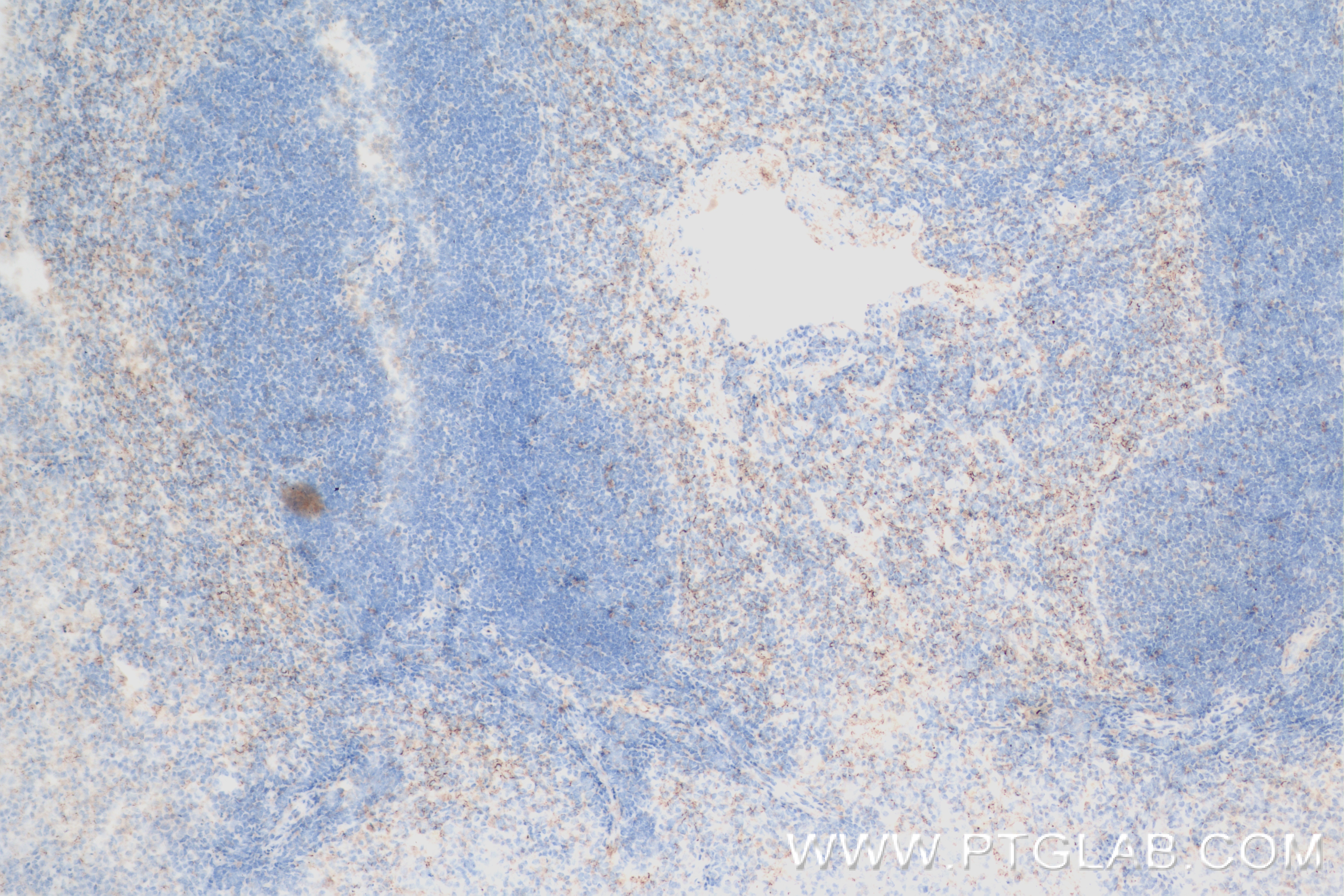 IHC staining of mouse spleen using 82953-2-RR