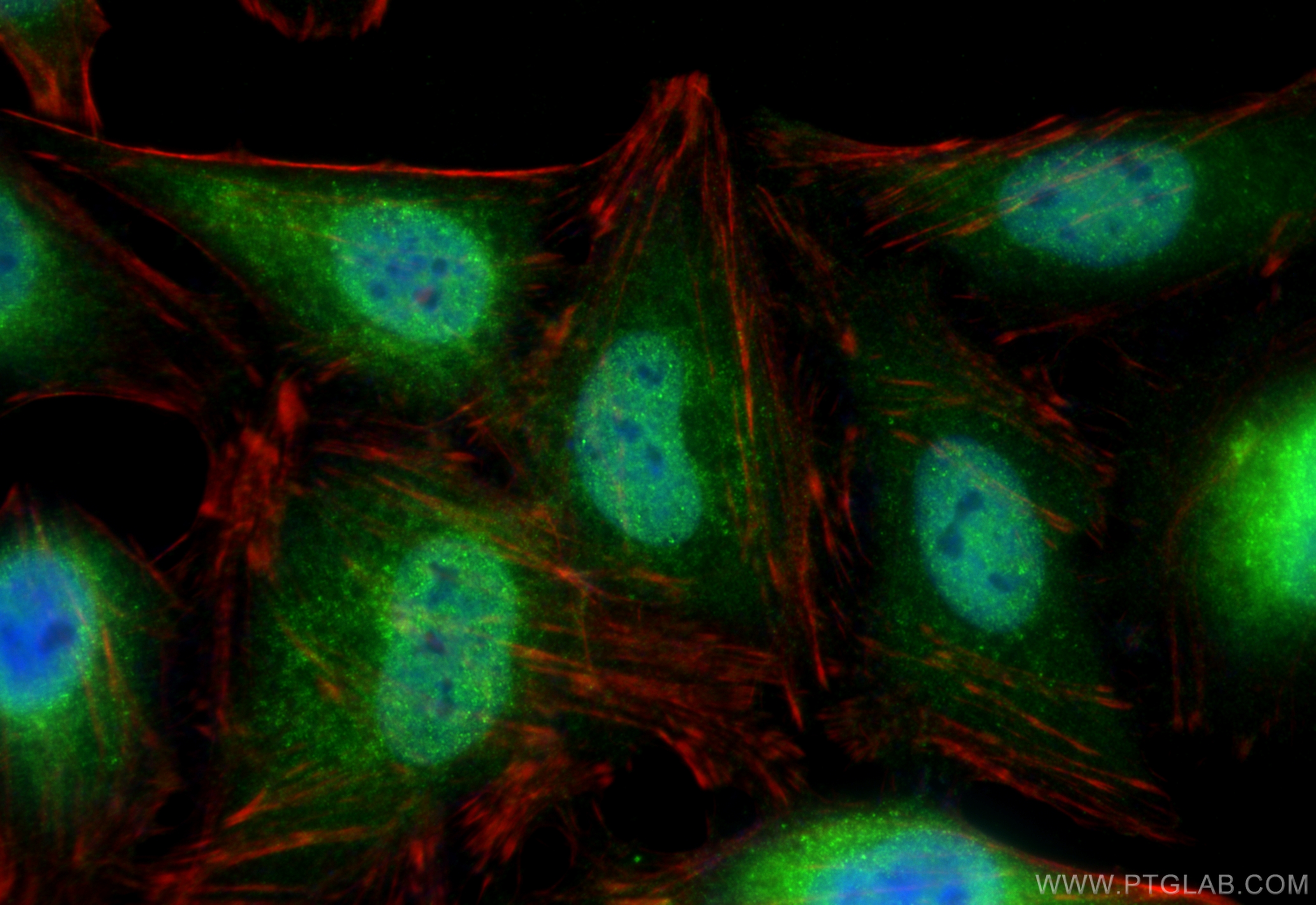 IF Staining of HeLa using 80992-1-RR